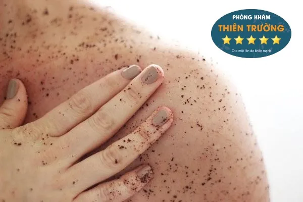 Hình ảnh: Massage tẩy da chết toàn thân