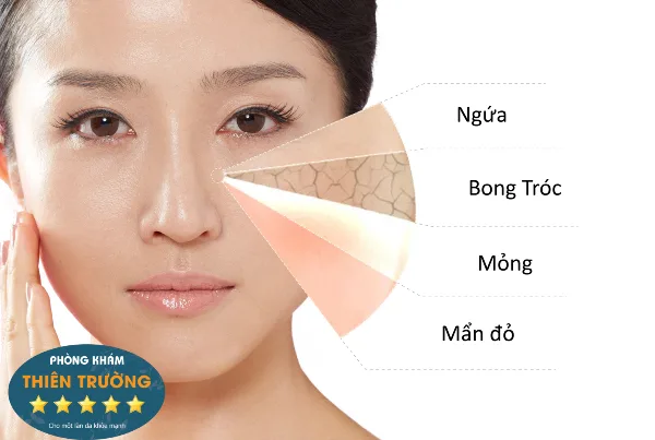 Hình ảnh: Biểu hiện của da khô