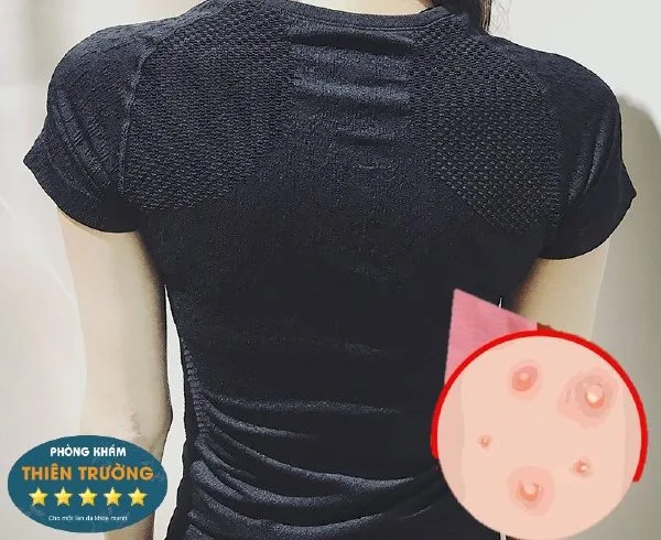 Hình ảnh: KHông nên mặc áo quá bó sát