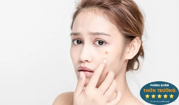 Hình ảnh: Nên trị thâm cho da đều màu hơn
