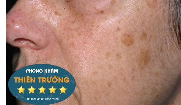 Hình ảnh: Đồi mồi
