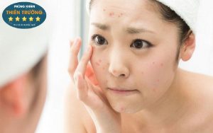 Hình ảnh: Mụn trứng cá