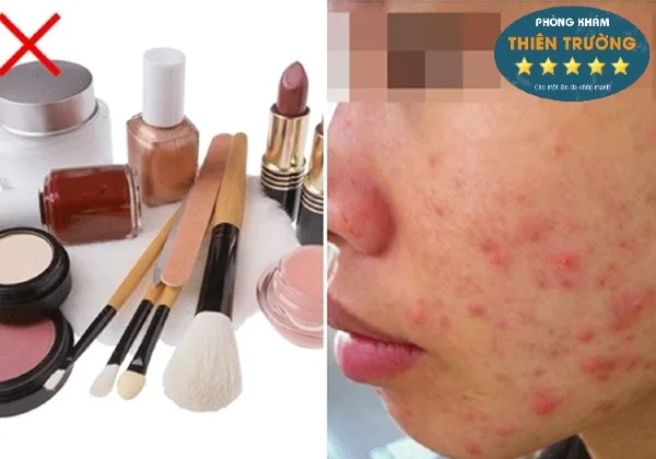 Hình ảnh: Không nên lạm dụng mỹ phẩm trang điểm.