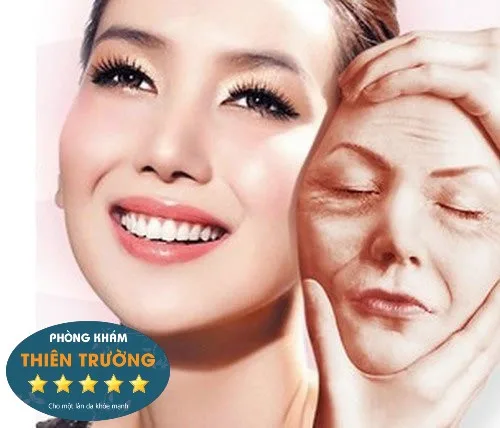 Hình ảnh: Căng da bằng chỉ