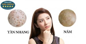 Hình ảnh: Nám tàn nhang