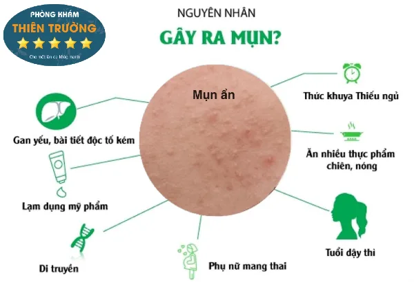 Hình ảnh: Nguyên nhân gây mụn ẩn