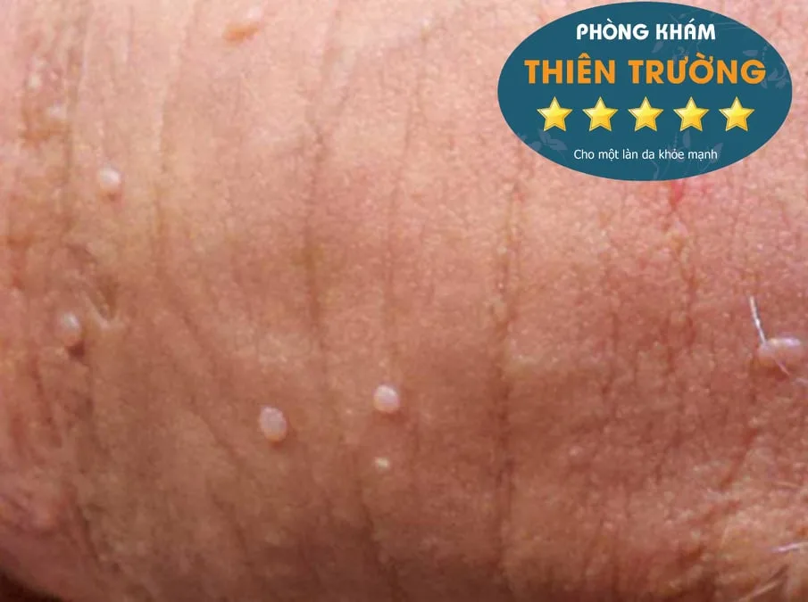 68955281_864393177278551_255699580887236608_n