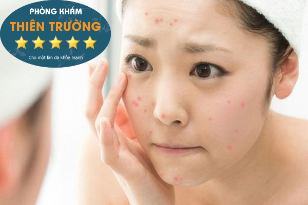 Bật mí về các bước skincare cho học sinh