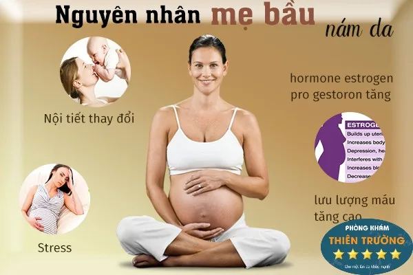 Hình ảnh: Nguyên nhân gây nám, tàn nhang cho mẹ bầu.