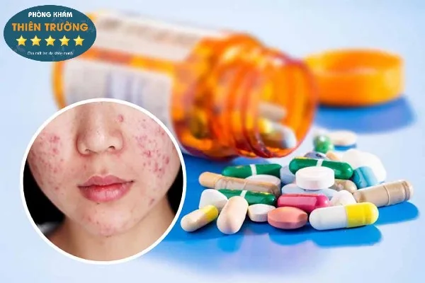 Hình ảnh: Nên sử dụng thuốc trong quá trình điều trị mụn và theo sự hướng dẫn của bác sĩ da liễu.