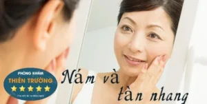 Hình ảnh: Nám và tàn nhang.