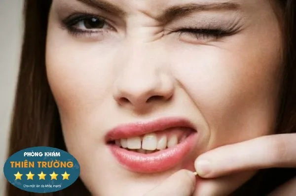 Hình ảnh:L KHông nên dùng tay tự ý nặn mụn.