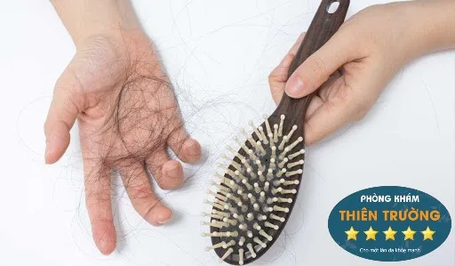 Hình ảnh: Viêm nhiễm da đầu cũng gây ra tình trạng rụng tóc