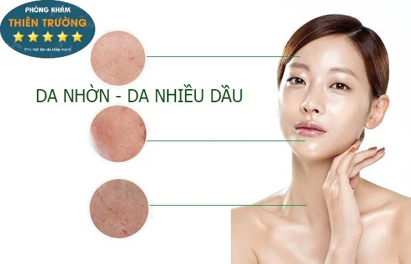Hình ảnh: Da dầu.