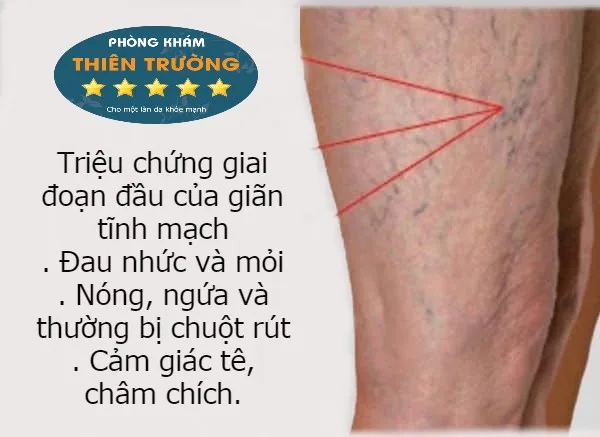Hình ảnh: Hậu quả của giãn tĩnh mạch.