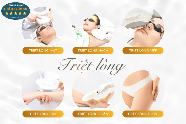 Hình ảnh: Triệt lông.