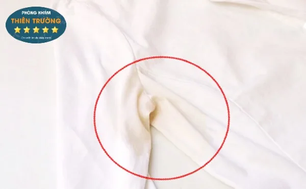 Hình ảnh: Mồ hôi nách tiết nhiều gây ô vàng áo.