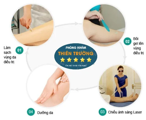 Hình ảnh: Quy trình triệt lông tại sapa