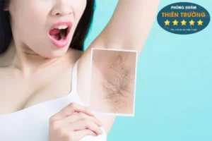 Hình ảnh: Triệt lông vùng nách.