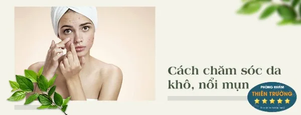 chăm sóc da mụn - Sao chép (2)
