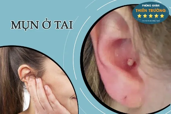 mun_o_tai 1234 - Sao chép