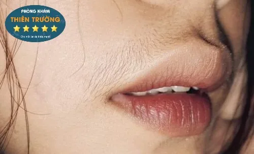 Hình ảnh: Lông ép - Ria mép.