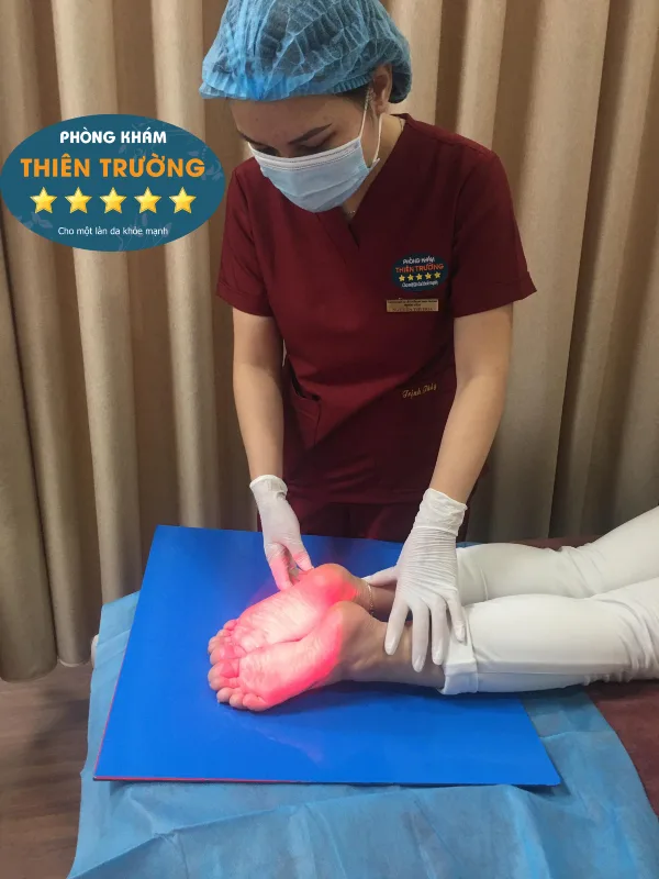 Hình ảnh: Hỗ trợ điều trị mồ hôi chân.