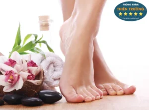 Hình ảnh: Biểu hiện ra mồ hôi tay chân.