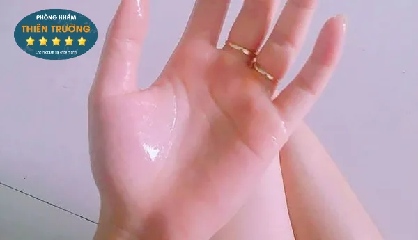 Hình ảnh: Mồ hôi tay.