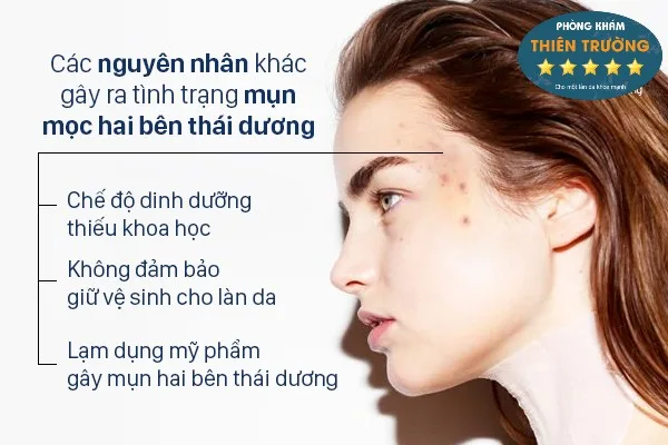 Hình ảnh: Mụn ở thái dương.