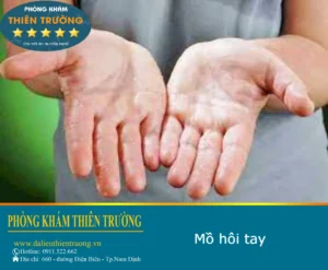 Hình ảnh: Đổ mồ hôi tay.