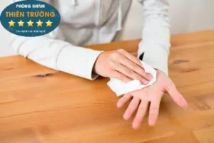 Hình ảnh: Đổ mồ hôi tay.