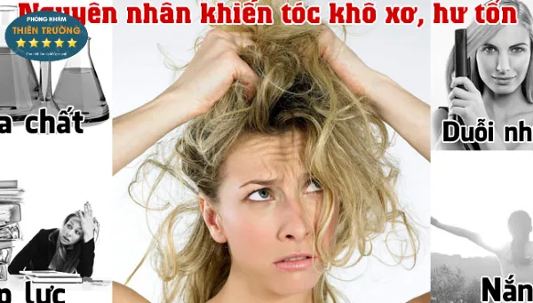 Hình ảnh: Rụng tóc có nhiều nguyên nhân gây nên