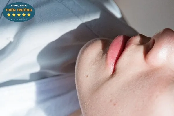 Hình ảnh: Da khô vẫn nổi mụn.