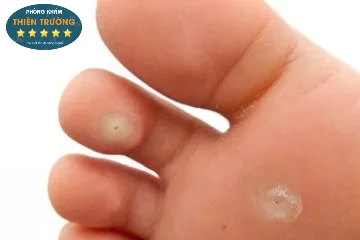 Hình ảnh : Hạt cơm