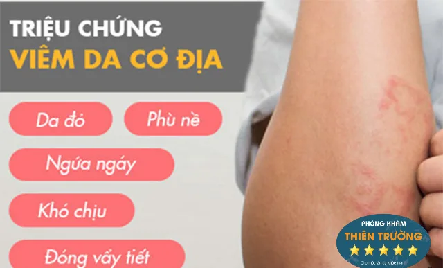 Hình ảnh: Triệu chứng viêm da cơ địa