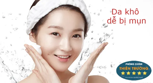 da khô dễ bị mụn