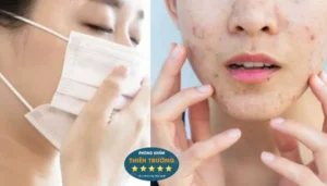 Hình ảnh: Chăm sóc da khi đeo khẩu trang