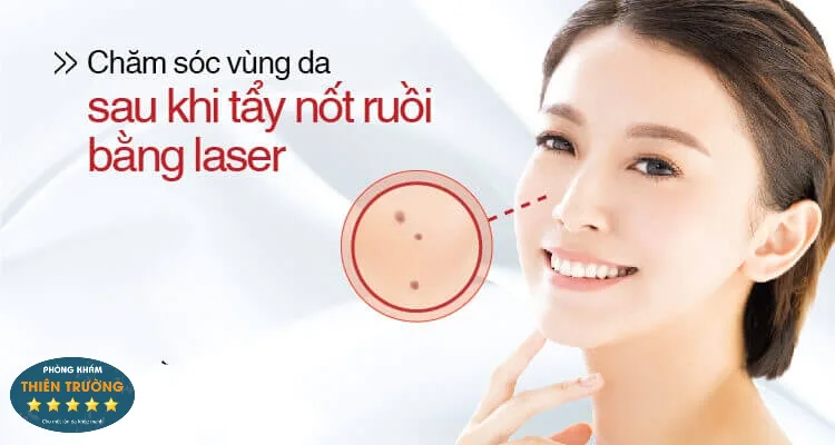 Hình ảnh: Chăm sóc vùng da sau điều trị.