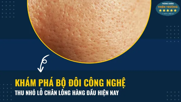 Hình ảnh: Dấu hiệu lỗ chân lông to