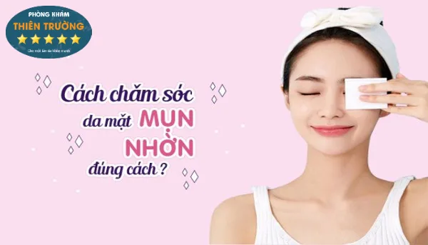 Hình ảnh : Cách chăm sóc da mụn.
