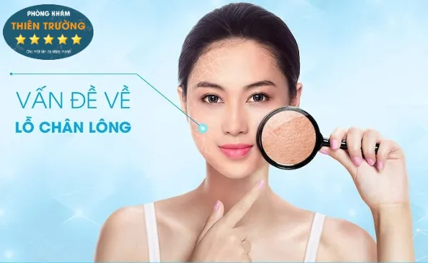 Hình ảnh: Vấn đề về lỗ chân lông 