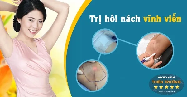 Hình ảnh: Hỗ trợ điều trị hôi nách nhanh chóng đơn giản mà hiệu quả