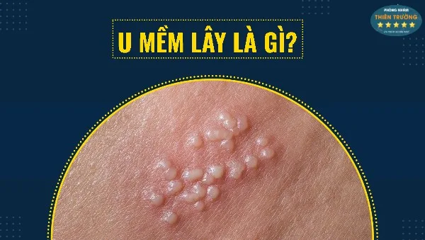 9.....(1)