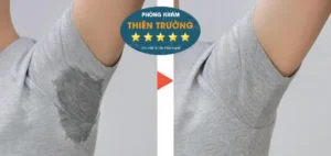 Hình ảnh: Trước và sau khi hỗ trợ điều trị hôi nách