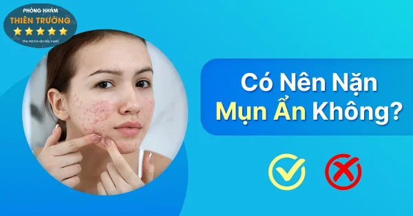 co-nen-nan-mun-an-khong