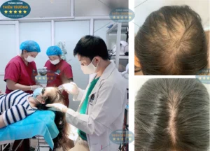 Hình ảnh: Thạc sĩ- Bác sĩ Nguyễn Văn Hoàn đang khám tóc cho khách hàng tại Phòng khám Da liễu thẩm mỹ Thiên Trường.