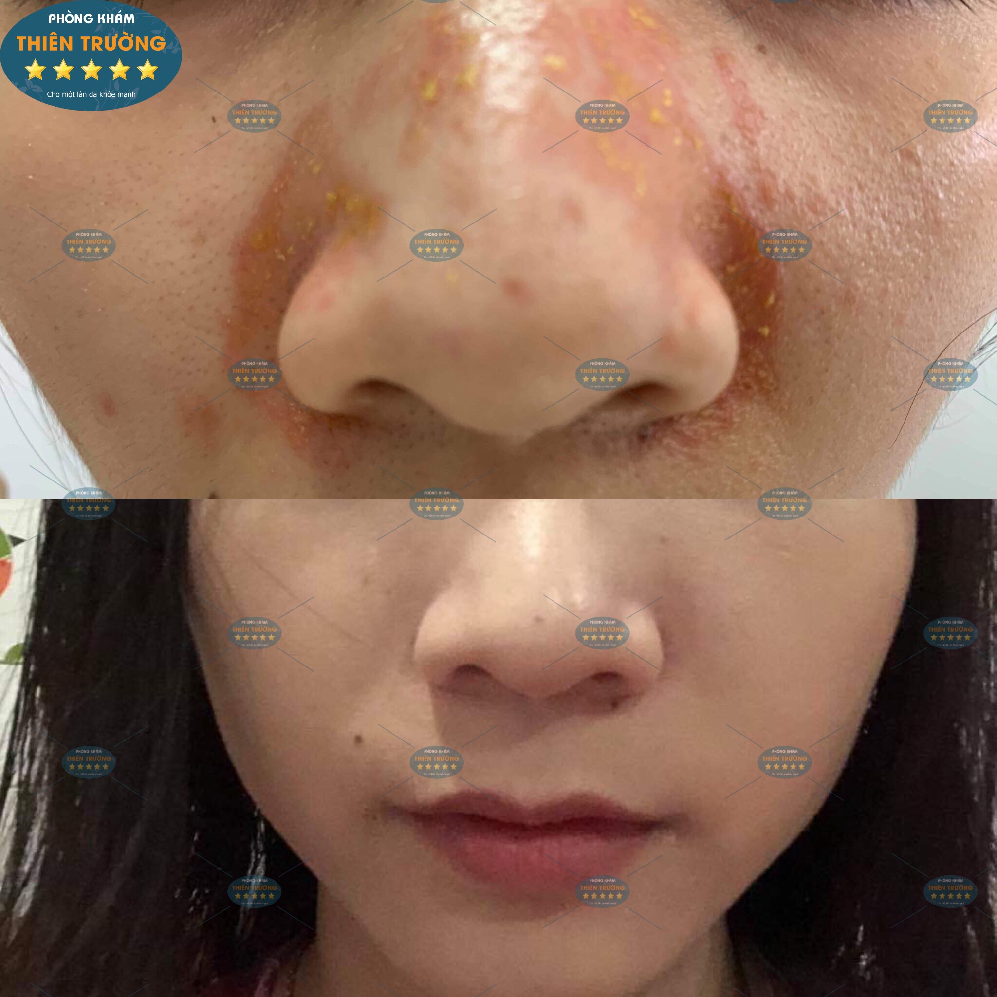 Hình ảnh: Viêm da