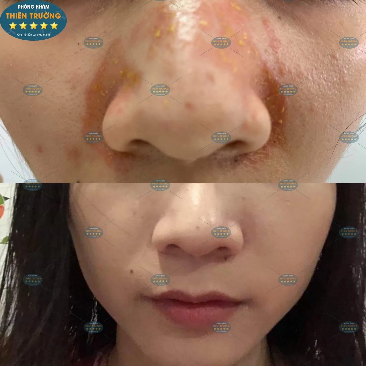 Hình ảnh: Viêm da