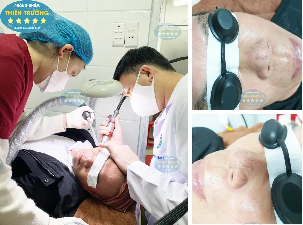 Hình ảnh: Phòng khám Da liễu- thẩm mỹ Thiên Trường.